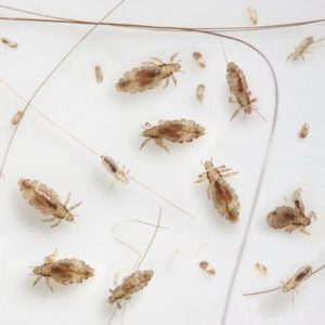 Lice Infestation Stages - Get Rid of Lice | A-Way With Lice®