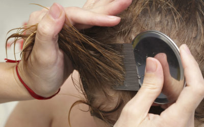 Important Head Lice Facts