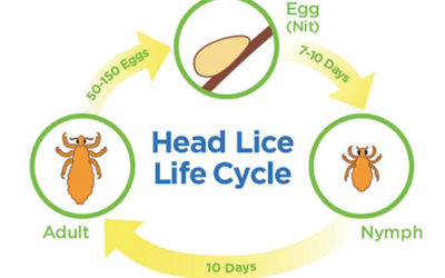 Lice Infestation Stages