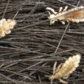 Lice Increase With Covid-19 Pandemic