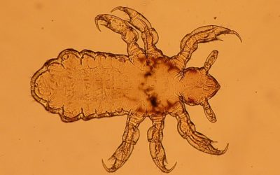 Interesting Lice History