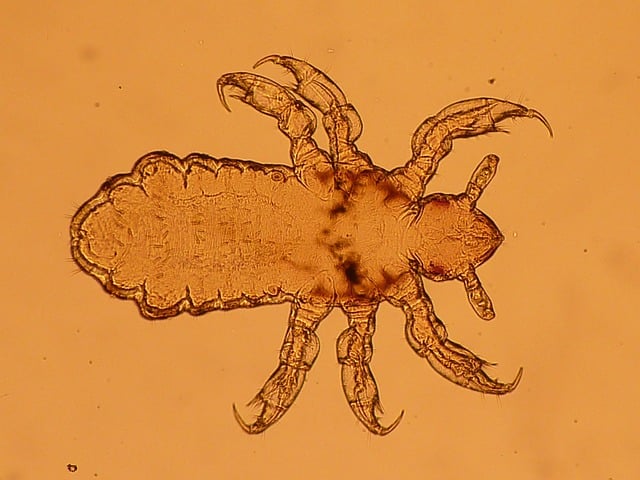 Interesting Lice History Interesting Lice History