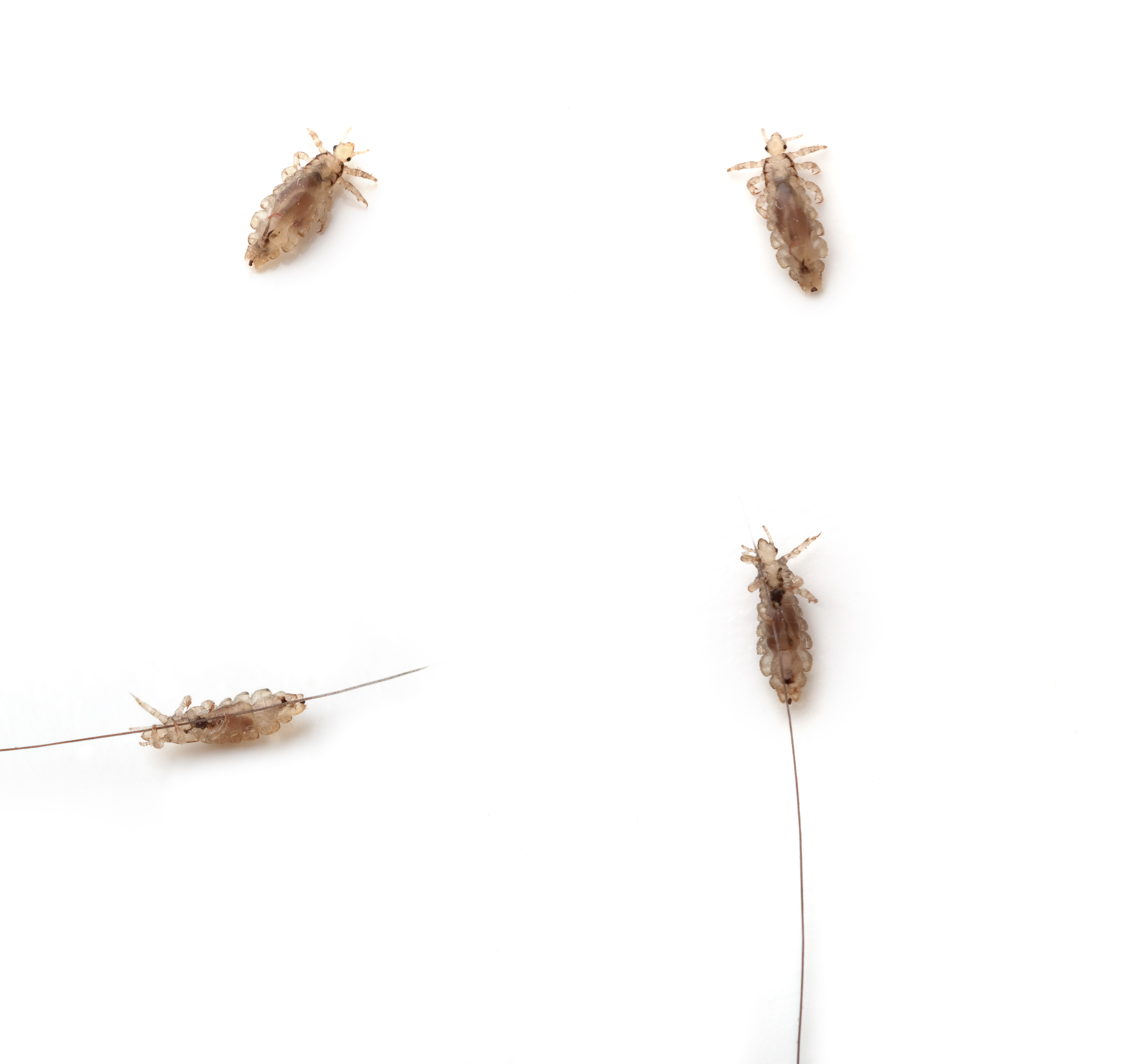 Worst Lice Story Worst Lice Story