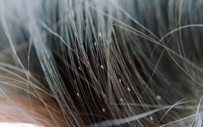 Head Lice Health Risk