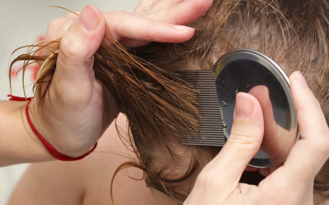Important Head Lice Facts