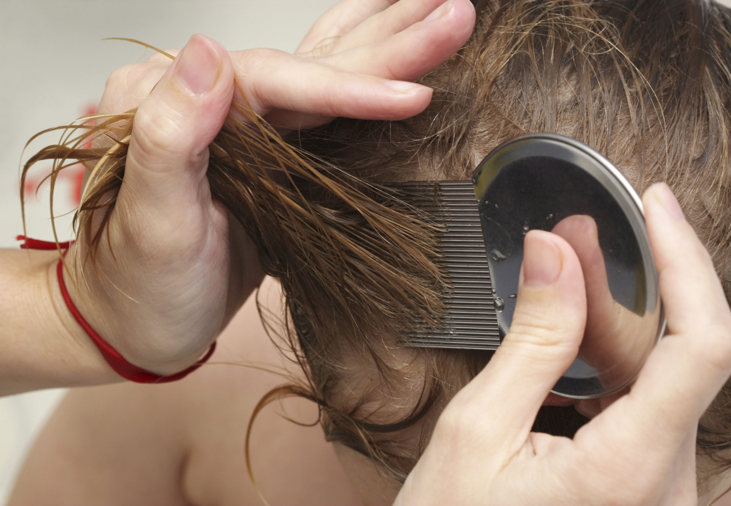 Important Head Lice Factss