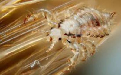 Fight Super Lice Tips