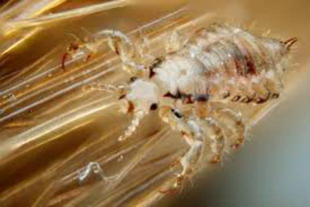 Fight Super Lice Tips Fight Super Lice Tips